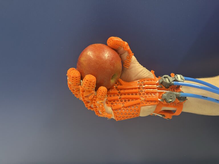 GraspAgain | Wiederherstellung der Handfunktion